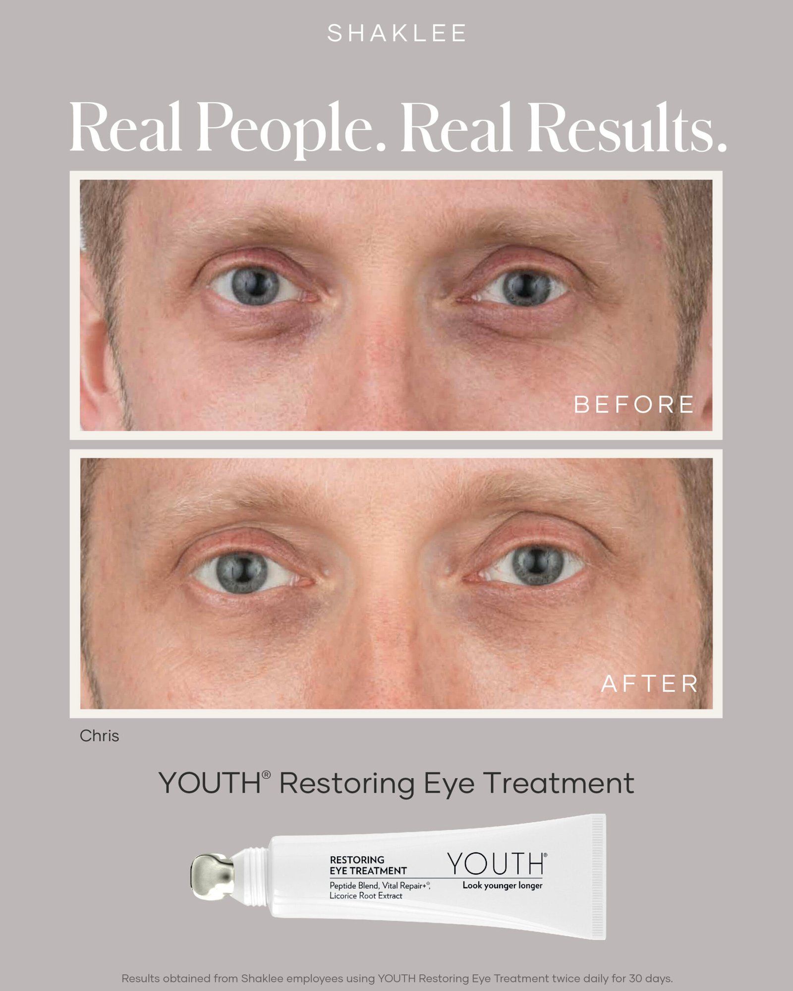 shaklee eye treatment - Shaklee Products shaklee eye treatment