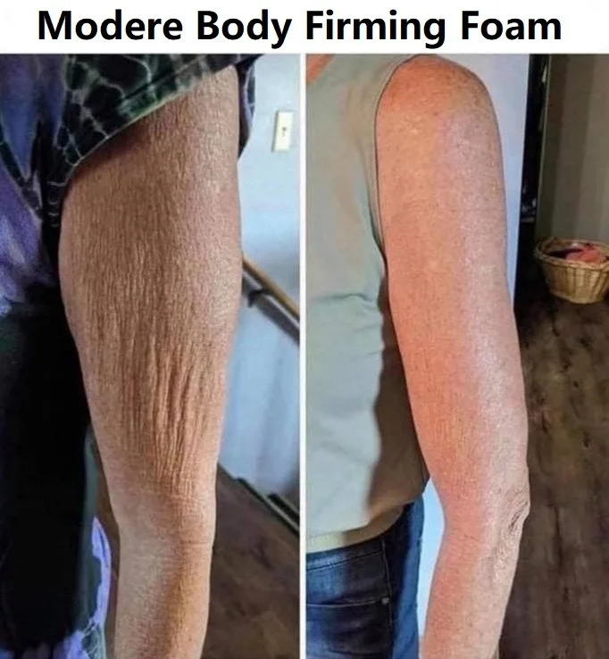 Modere CellProof Body Firming Foam Australia - Image 5 - Shop Shaklee Australia Before-and-after arm photos showing smoother, firmer skin after using Modere Body Firming Foam; left dull, wrinkled skin vs right tightened skin.